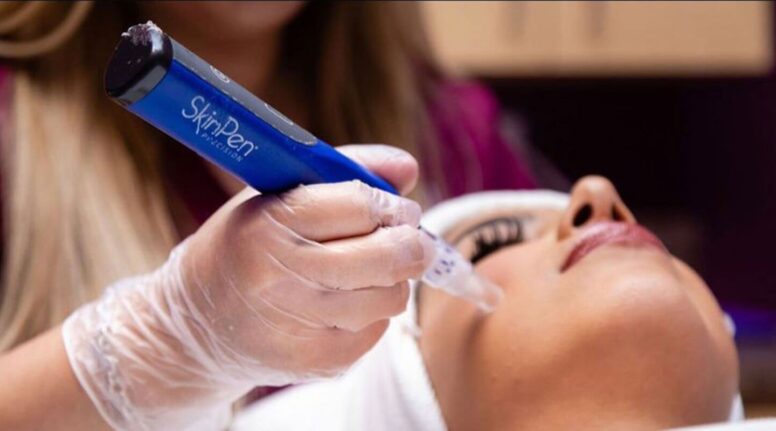 SkinPen Microneedling