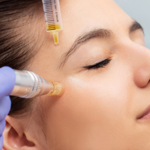 Microneedling Packages